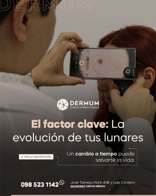 Un cambio a tiempo puede salvarte la vida. De todas las características que evaluamos en dermatologí