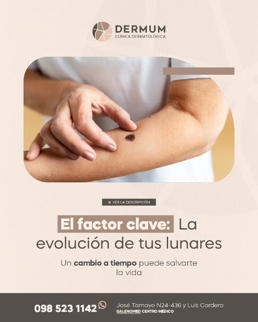 Un cambio a tiempo puede salvarte la vida. De todas las características que evaluamos en dermatologí