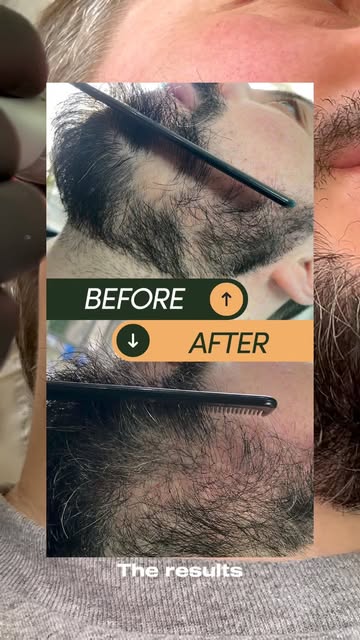 Results that speak for themselves 👏

A closer look at the difference targeted treatment can make to