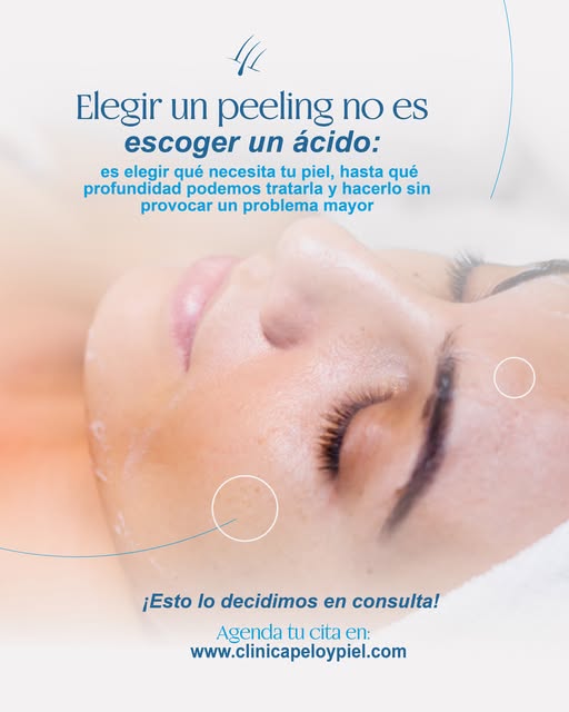 Un peeling médico puede ayudarnos a tratar manchas, acné, textura irregular, poros visibles, exceso 