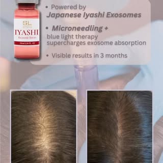 Think microneedling... but elevated. 👀 Our signature scalp treatment now features Iyashi Exosomes, 