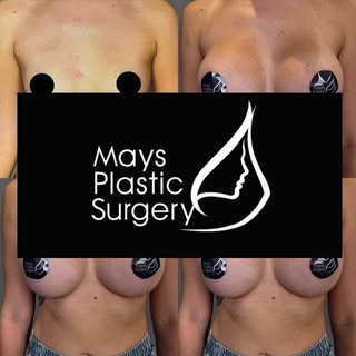 Summer may be coming to an end but the aMaysing results are here to stay. 
@maysplasticsurgery has e