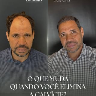 Muda a relação consigo mesmo.

Muda a forma de se olhar, de se posicionar e de se sentir seguro.

El