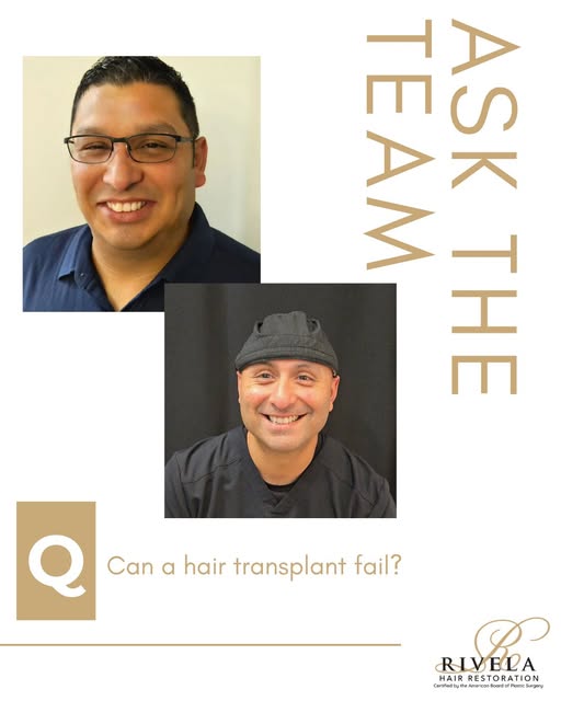 While hair transplants can provide long-lasting, natural-looking results, factors such as improper t
