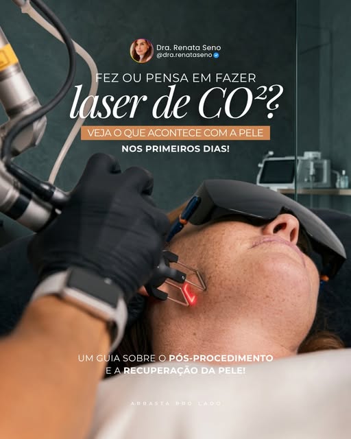 “Dra., quanto tempo meu rosto vai ficar vermelho depois do laser de CO₂?”

Essa é uma das dúvidas qu