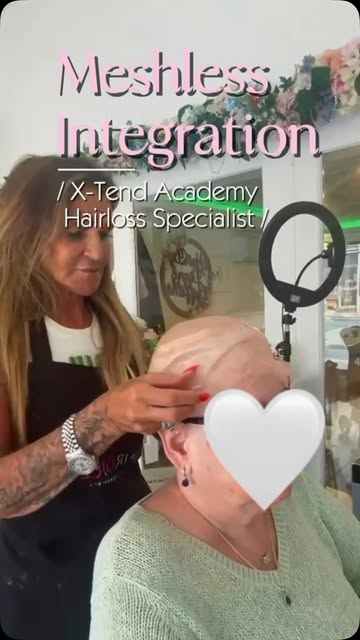 WHEN HAIR LOSS CHANGES MORE THAN YOUR HAIR… 🤍

This beautiful Meshless Integration transformation w