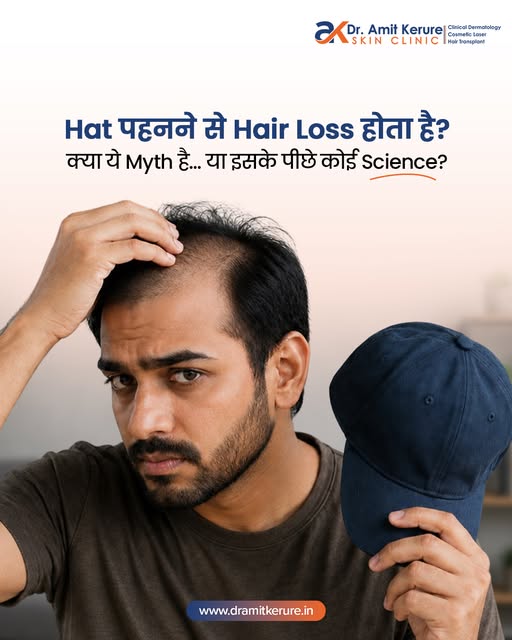 Does wearing a hat cause hair loss? 

NO! It is just a myth. Your hair follicles are deep beneath th