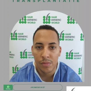 Een haar- en baardtransplantatie kan inderdaad gecombineerd worden in één enkele ingreep. Dit wordt 