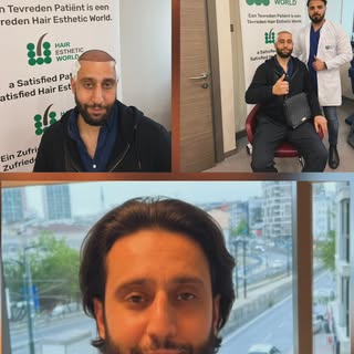 Verander je uitstraling met een haartransplantatie en herwin je zelfvertrouwen. Neem gerust contact 
