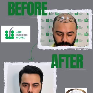 Niet alleen haar groeit… ook zelfvertrouwen.
Geduld vandaag, trots morgen.

It's not just hair that 