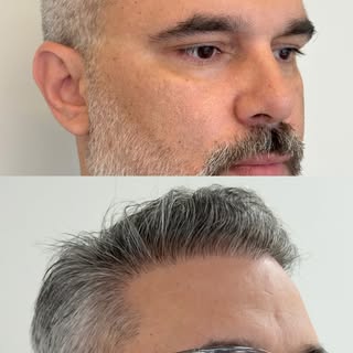 Quando o resultado é natural e bem planejado, ele devolve a confiança, melhora a autoestima e faz o 