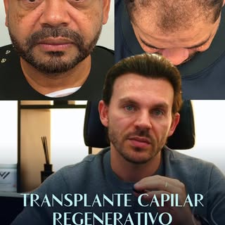 medicina regenerativa está mudando a forma como enxergamos a alopecia. O objetivo não é apenas estim
