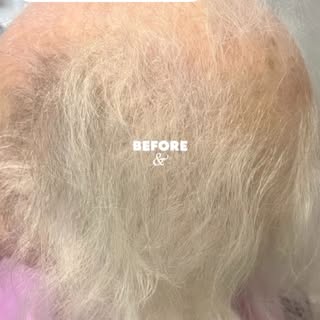 TRANSFORMATION!!!!!! 
This lovely ninety year old lady looks so much younger with the help of more h