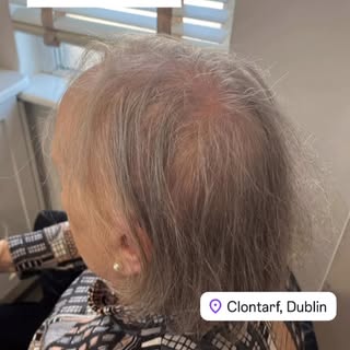Partial hair piece – Lightweight, comfortable, and incredibly easy to use. Instantly adds volume and