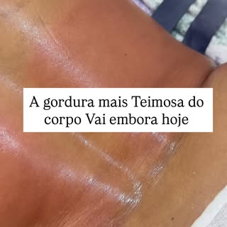 @gabriellaribeiroestetica 

Você malha, se cuida, mas aquela gordurinha na barriga continua ali? 👀

