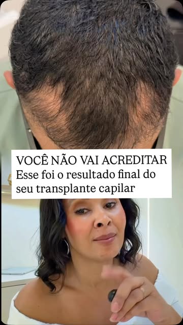 A cirurgia terminou, mas a frustração ficou.

Este caso chamou muito a minha atenção pelo estado emo