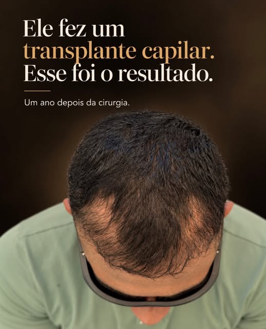 A cirurgia terminou, mas a frustração ficou.

Quando ele chegou à minha clínica, estava emocionalmen