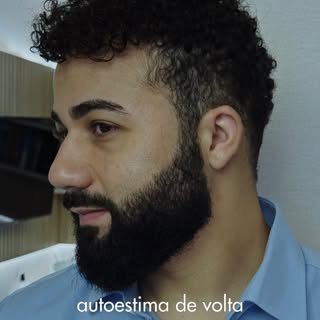 Uma decisão importante raramente é tomada por impulso. Antes de realizar o transplante capilar, o Vi