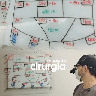 Antes da cirurgia, esse paciente tinha uma necessidade estimada de 7 mil folículos.

Com o acompanha