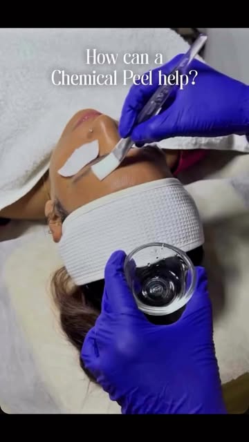 Refresh your skin with a chemical peel tailored to your concerns. ✨

Stimulates collagen production.