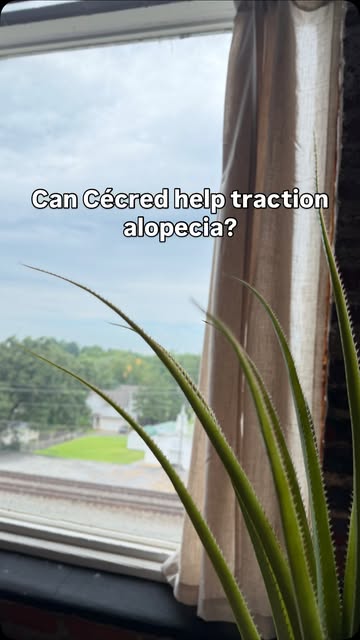 Losing hair after braids? That can be more than normal shedding.

Repeated tension from braids and o