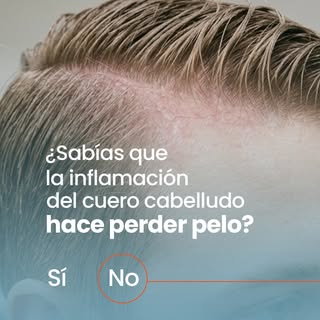 La caída no siempre empieza en el pelo.

A veces empieza en la inflamación del cuero cabelludo.

Cua