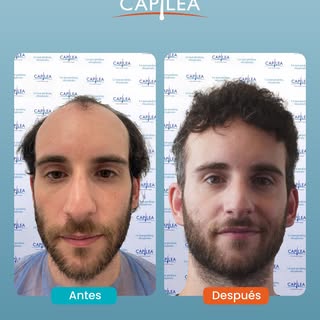 Antes, encendía la cámara en las videollamadas solo cuando era estrictamente necesario.

Luego, dejó