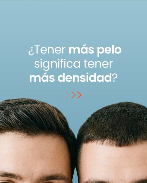 Tener pelo no es lo mismo que tener densidad.

La densidad no depende solo de cuánto pelo tienes, si