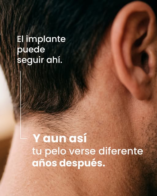 Pensar un implante solo para “hoy” sería mirar la mitad del problema.

También hay que preguntarse q