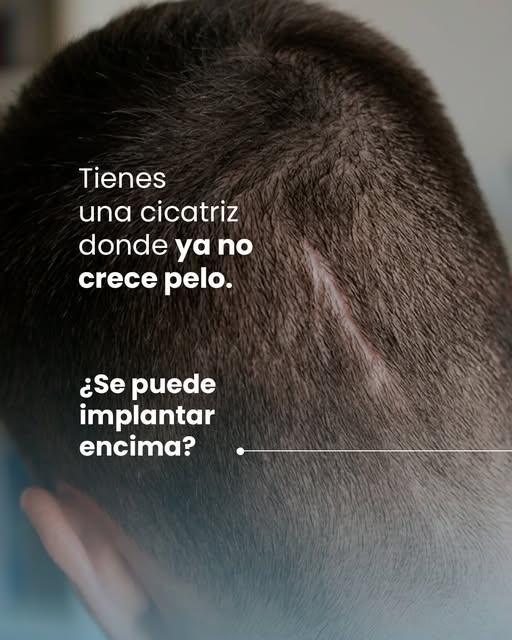 Dos cicatrices del mismo tamaño pueden necesitar planes completamente distintos.

¿Por qué? Porque l