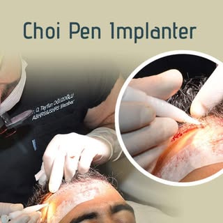 Hair Transplant Course
Hair Transplant training courses are hands-on and tailor-made for the attende