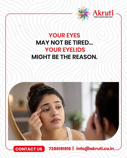 Your eyes may not be tired — your eyelids could be making you look that way. 👁️✨

With time, excess