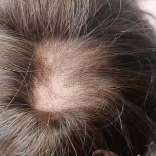 ❤️ Wig repair ❤️

#haaratelierchristel 
#wigmaker 
#wigrepair 
#haarknopen 
#