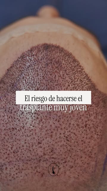 Querer recuperar tu pelo lo antes posible es normal. Pero operar antes de tiempo puede complicar tod