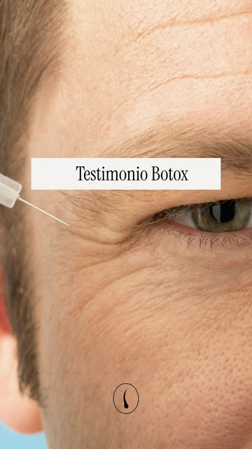 Cada vez más hombres se animan — y ninguno se arrepiente.

Botox natural, sin exageraciones y con re
