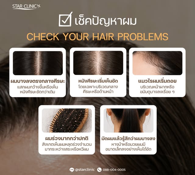✨การรักษาแบบไหน…เหมาะกับคุณ?
เพราะผมร่วง ผมบาง แต่ละคนมีปัญหาไม่เหมือนกัน

💛 โปรแกรม EXOSOME HAIR
ส