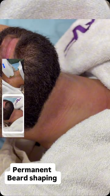 हर दिन Beard Shape करने की झंझट से छुटकारा! 🔥

अब पाएं अपनी पसंद की Sharp और Defined Beard Line — A