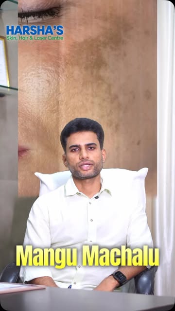 మంగు మచ్చలు… మీరు ఎన్ని సంవత్సరాలు మందులు వాడినా తగ్గట్లేదా? 😟

మంగు మచ్చలు (Melasma) తగ్గాలంటే కేవ