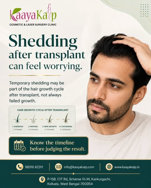 Shedding after a hair transplant can feel worrying—but it doesn’t always mean the treatment has fail