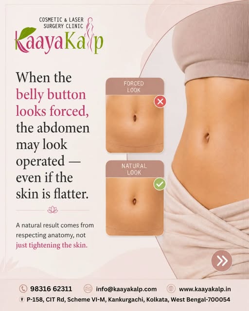A flatter abdomen alone doesn’t always create a natural-looking result.

When the belly button appea