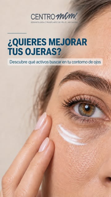 No todas las ojeras se tratan igual.🌷
El color de tu ojera y el tipo de piel importan. Por eso en C