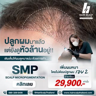 📣📣 #ปลูกผมมาแล้วแต่ยังดูหัวล้านอยู่😓 
..
✔️กราฟท์ผมขึ้นไม่แน่น ✔️ช่องว่างของเส้นผมห่าง
✔️เห็นหนัง