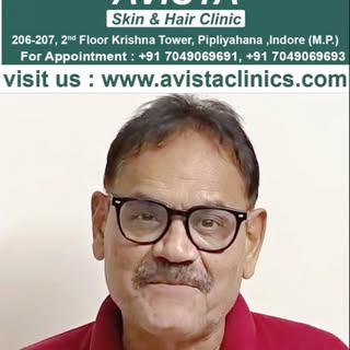New look, new vibe! Mushtaq Khan's hair transformation. 
#HairTransplantJourney #BeforeAndAfter #Hai