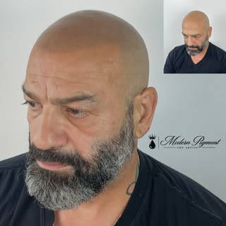 Natural. Clean. Undetectable. 👌

Scalp Micropigmentation isn’t about creating the darkest or sharpe