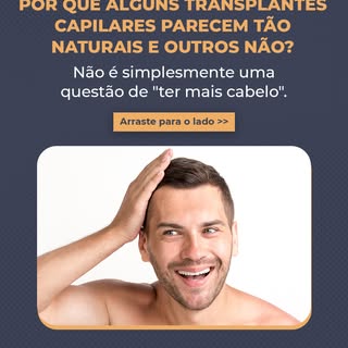 Um transplante capilar natural não depende apenas da quantidade de fios.

Quando falamos em naturali