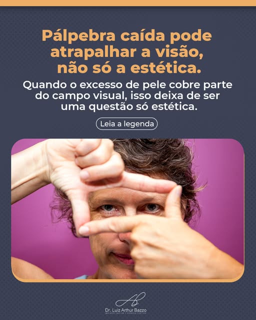 Existe uma associação muito forte entre blefaroplastia e "querer parecer mais jovem" e isso faz muit