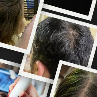 Hair loss doesn’t discriminate — and neither do our solutions. 👥

Men and women often experience ha