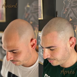 Magnifique avant / après ✨ fini les golfes creusés et le manque de densité... 
Je fais tout mon poss