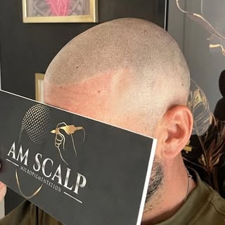Magnifique résultat 🔥 une nouvelle vie commence ✨✌🏻

Comment en bénéficier ? ⤵️

Avec la tricopigm