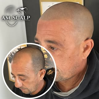 Faire sa tricopigmentation en plein été ? C’est un grand OUI ! ☀️
On pense souvent qu'il faut attend